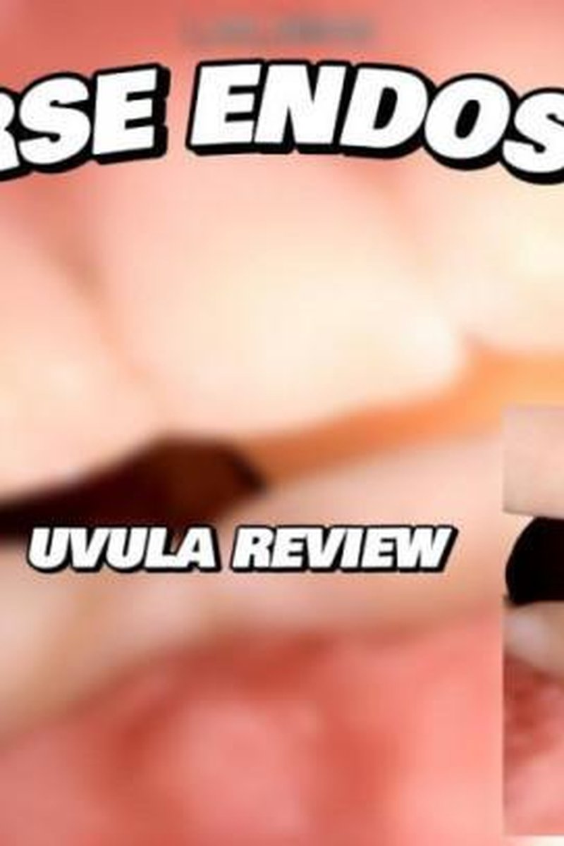 Reverse Endoscope - Screenshot 1 of 4 - Endoscopethroat