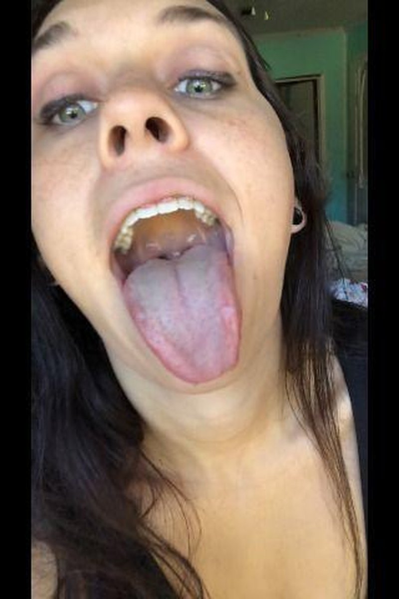 Vore With Braces - Screenshot 1 of 4 - Braces