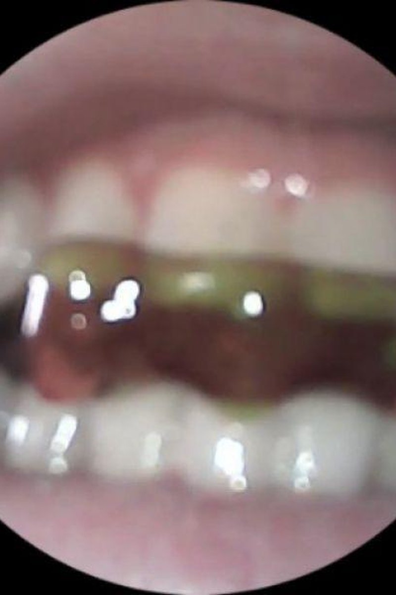 Teasing Tiny- Endoscope View - Screenshot 1 of 4 - Fetish
