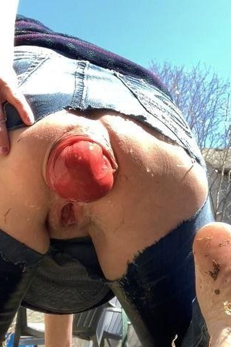 Backyard Anal Prolapse & Chores - Screenshot 1 of 4 - Anal