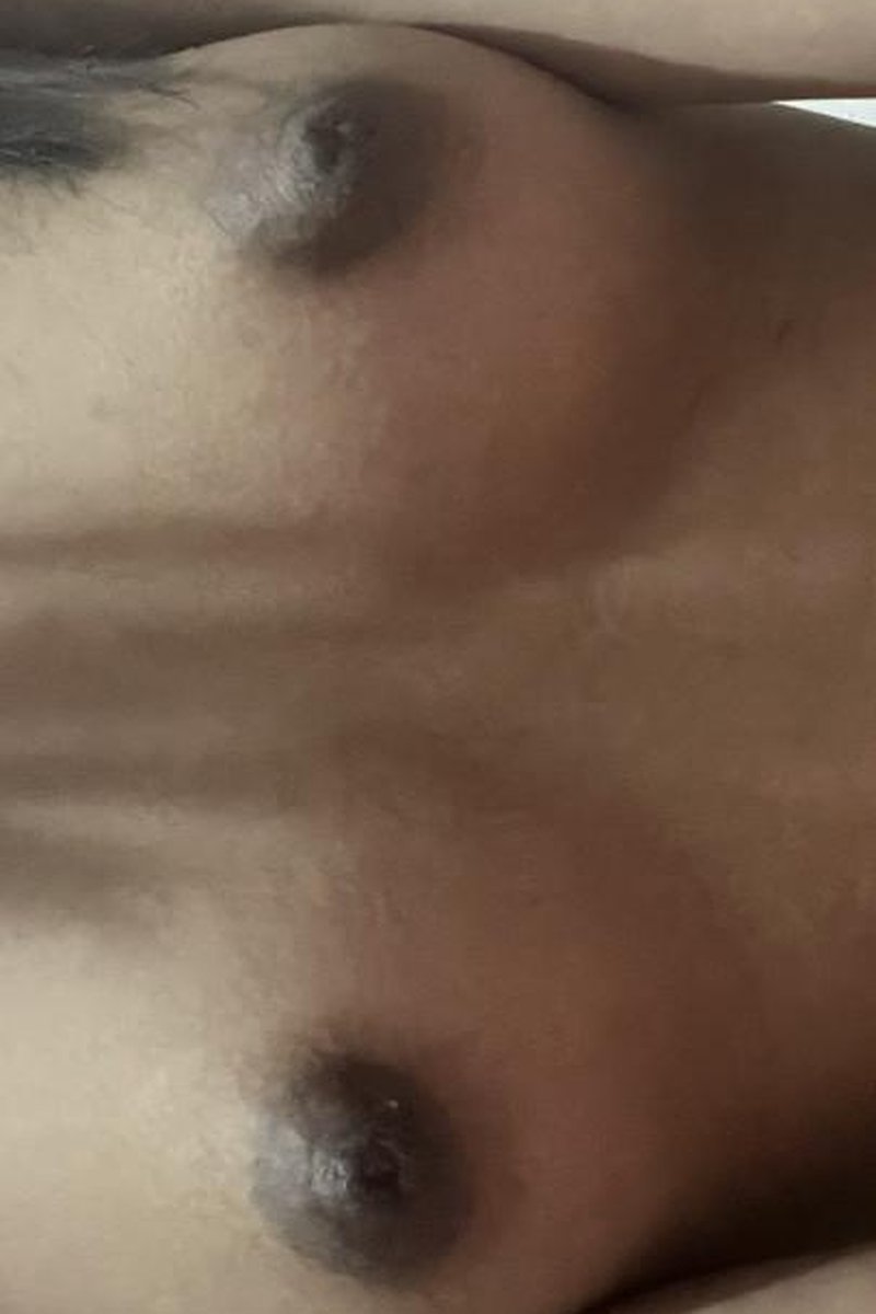 Teasers - Screenshot 1 of 4 - 18years