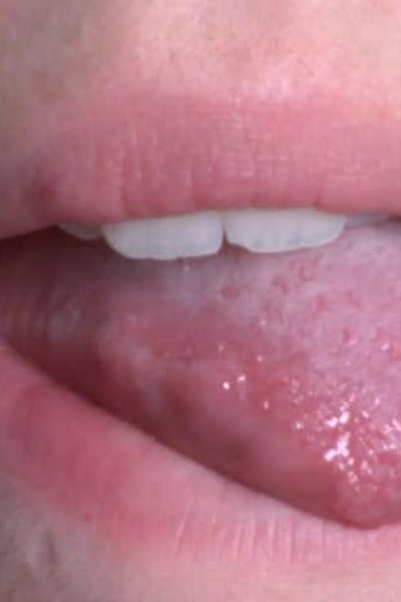 Mouth Fetish Extreme Close-Up - Screenshot 1 of 4 - Close Up
