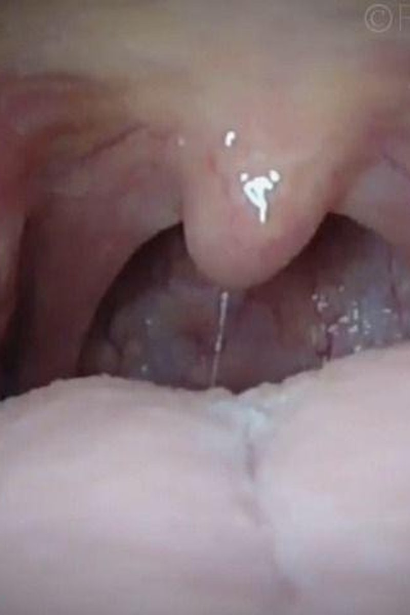 Hansel & Gretel Vore - Screenshot 1 of 4 - Fetish