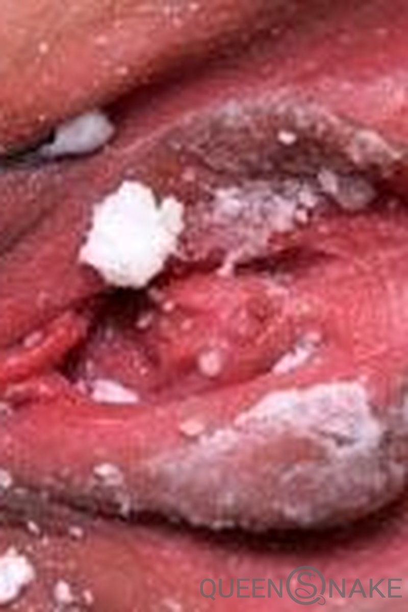 Bonfire - Screenshot 1 of 4 - BDSM