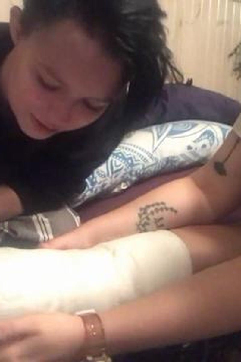 Rewrapping My Cast - Screenshot 1 of 4 - Cast