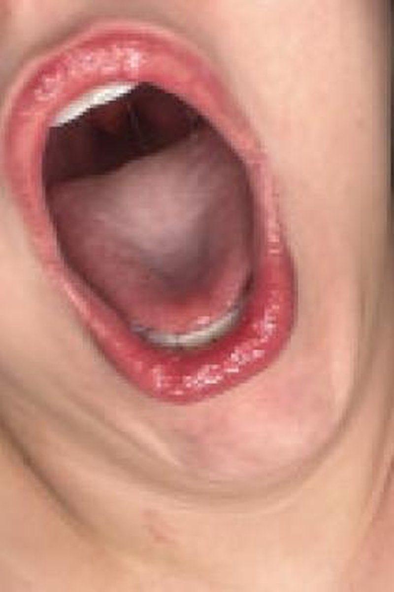 Yawning - Screenshot 1 of 4 - Lipstick Fetish