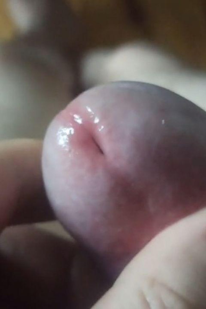 Macro Ejaculation - Screenshot 1 of 4 - Cumshot