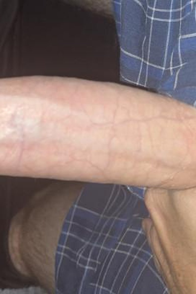 Glazee - Screenshot 1 of 4 - Bitch