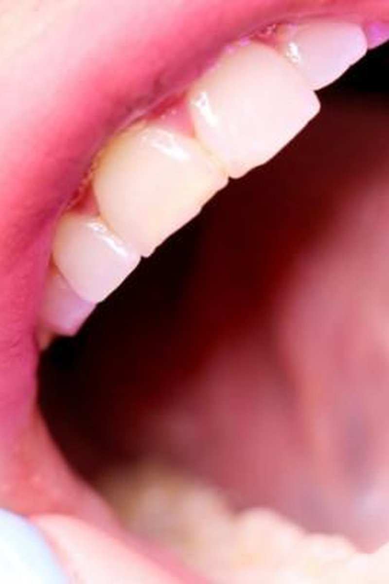 Teeth Up Close - Screenshot 1 of 4 - Mouth Fetish
