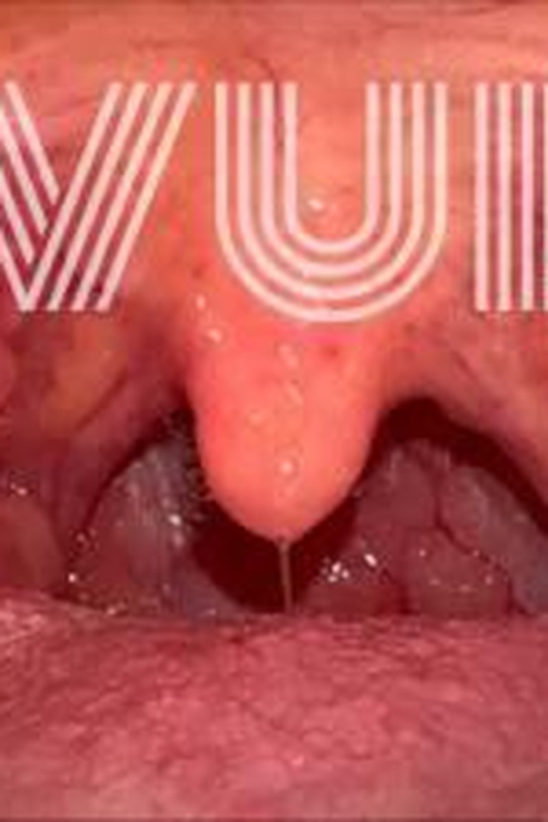 Uvula - Screenshot 1 of 4 - Beautiful