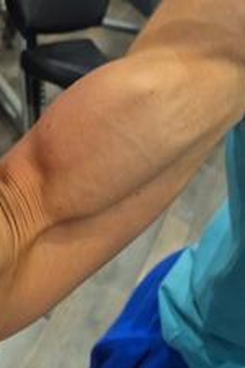 Naamabiceps - Screenshot 1 of 4 - Arm Fetish