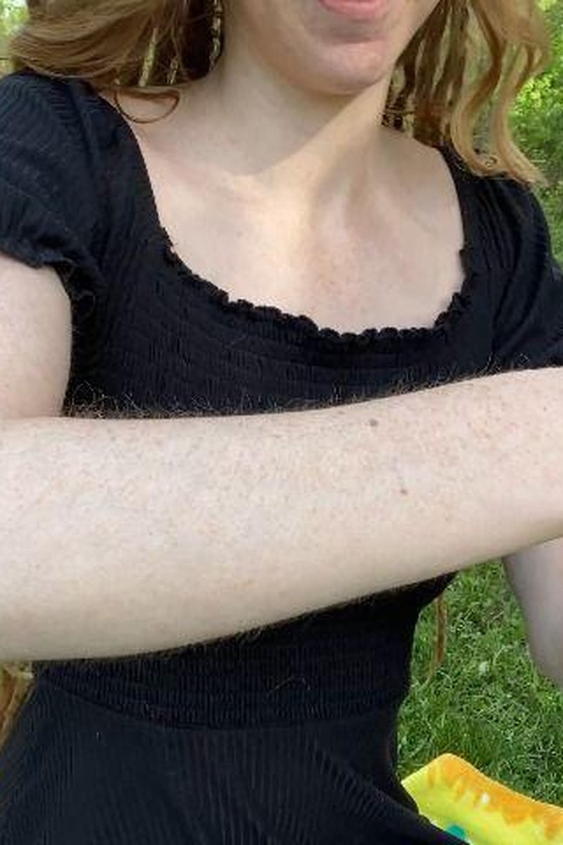Hairy Arms And Goosebumps - Screenshot 1 of 4 - Fetish
