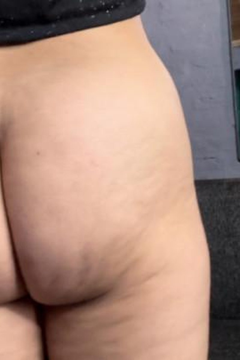 Ass Squishing - Screenshot 1 of 4 - Ass Clenching