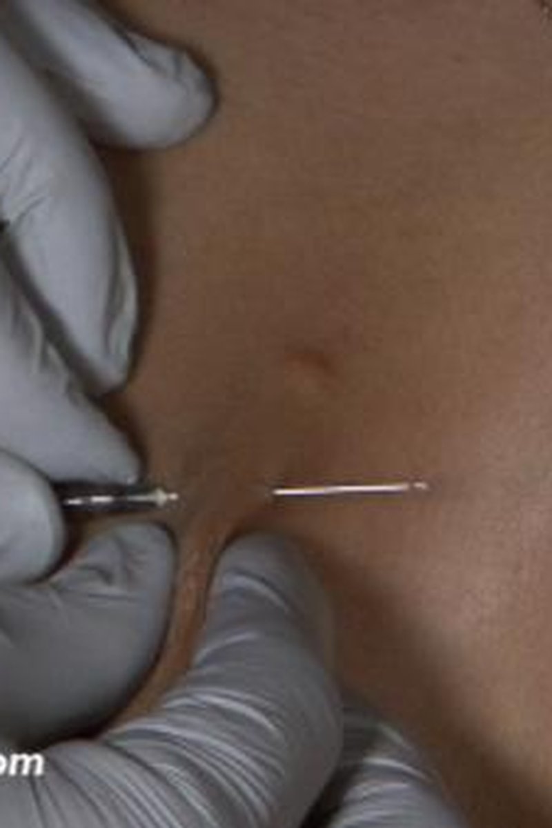 Play Piercing: Getting Started - Screenshot 1 of 4 - Medical Fetish