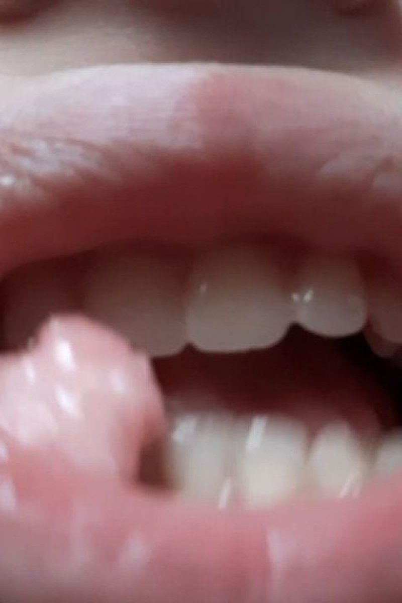 Chewing - Screenshot 1 of 4 - Chewed