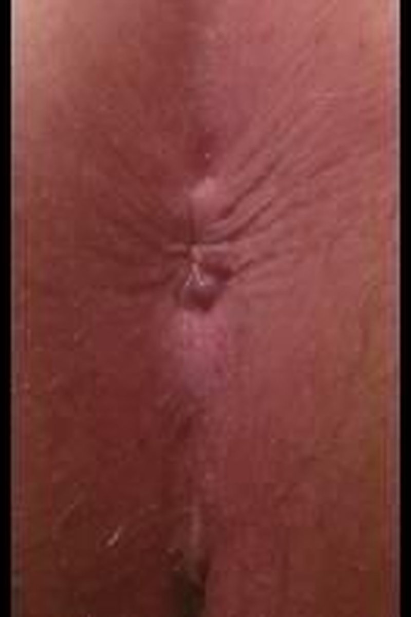 Starfish - Screenshot 1 of 4 - Ass Fetish