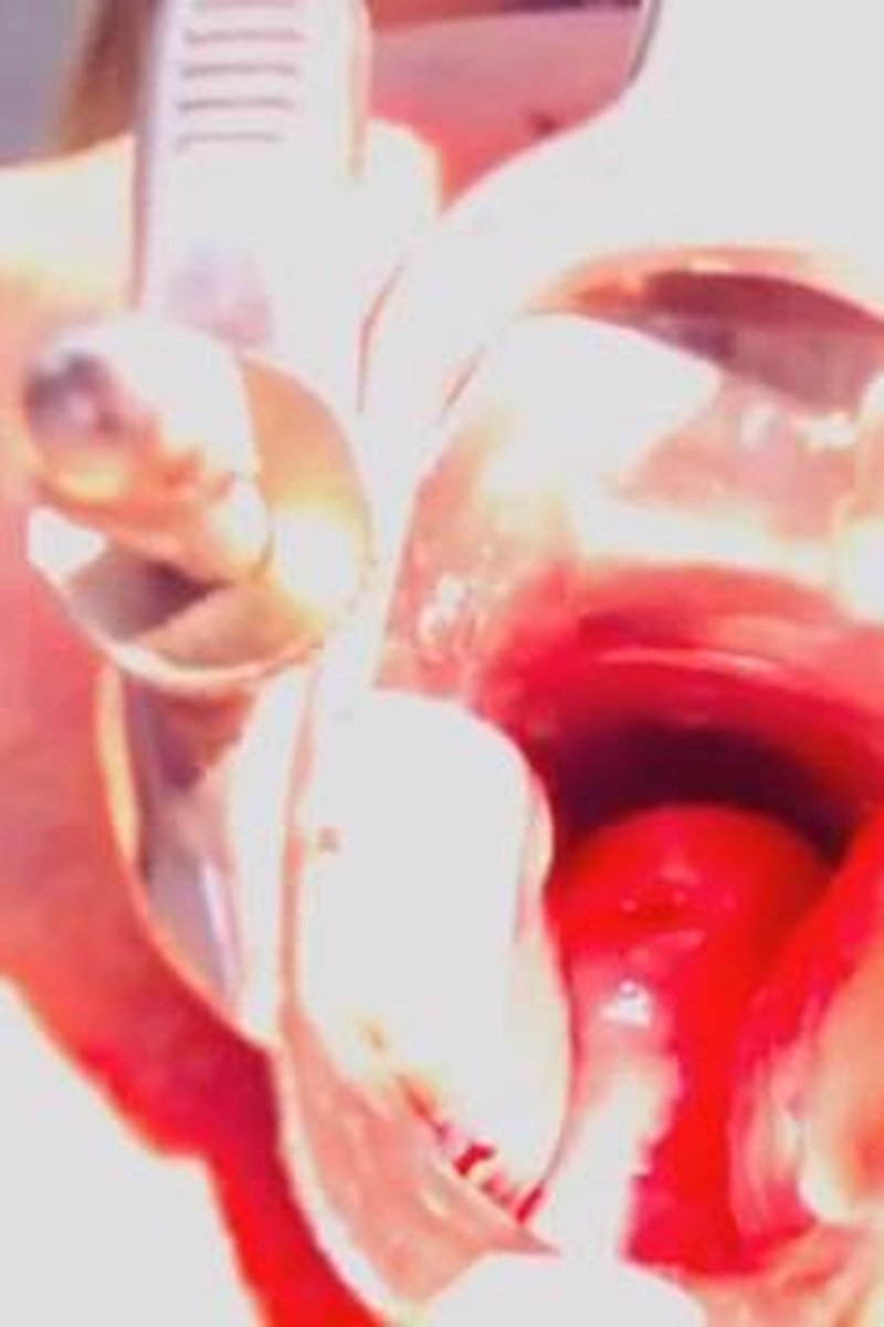 Speculum Study - Screenshot 1 of 4 - Close Up