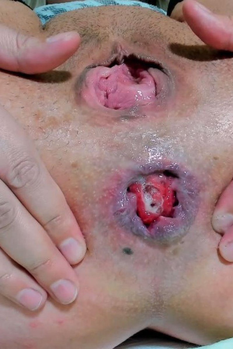 Andrada Ass Open - Screenshot 1 of 4 - Anal