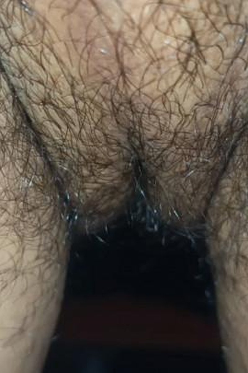 Scrotum Close Up View - Screenshot 1 of 4 - Close Up