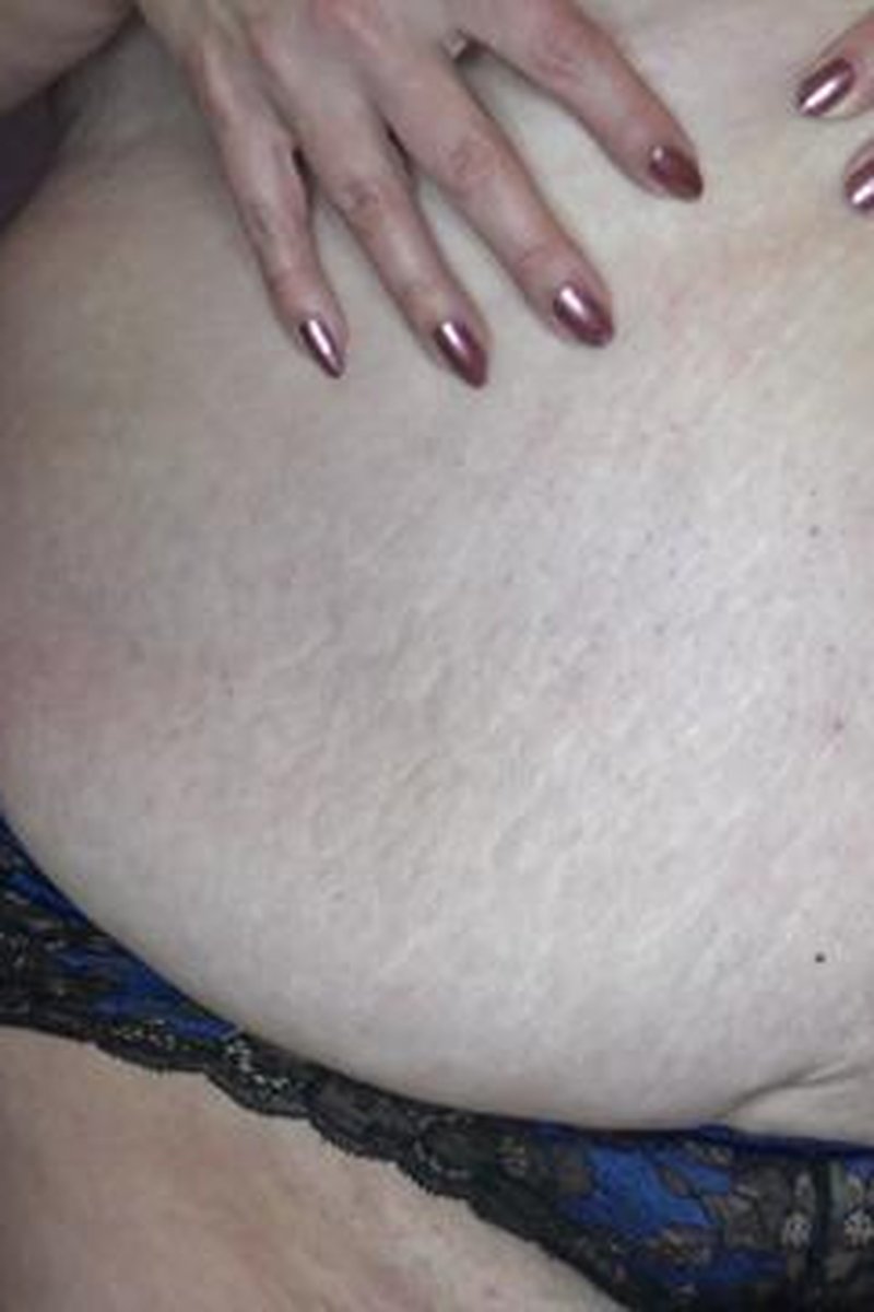 Stretchmarks - Screenshot 1 of 4 - BBW